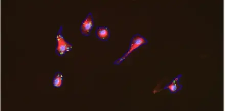 Lipid Droplets