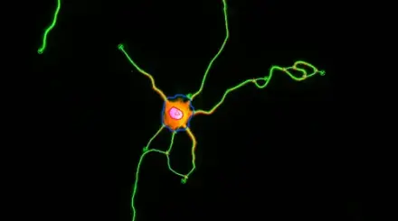 Neurite Outgrowth